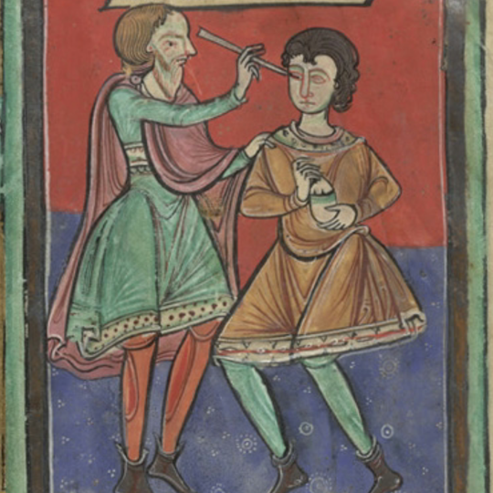 Vypichnuté oko ako Boží dar? #57